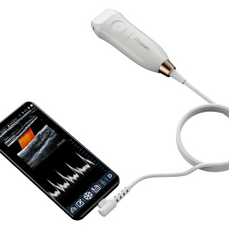 Handheld Ultrasound